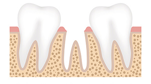 teeth image