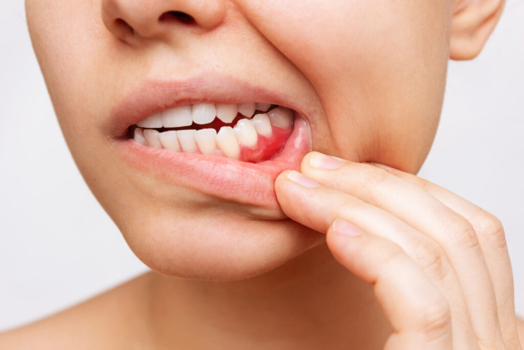 Periodontist in South Ogden and Kaysville