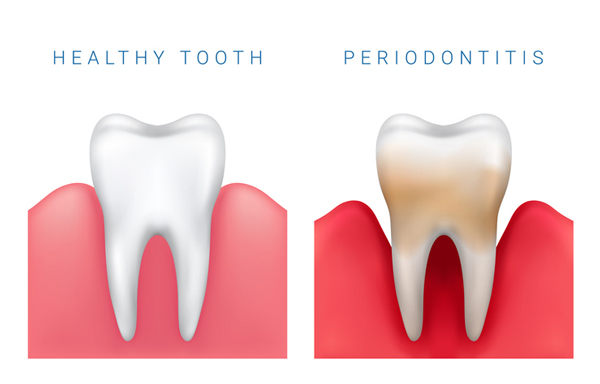 dental comparison