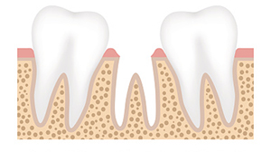 teeth image 